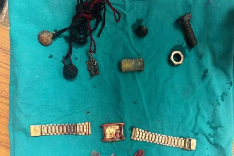 SMS Hospital Stomach Surgery