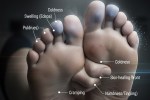 Signs of poor circulation in feet,