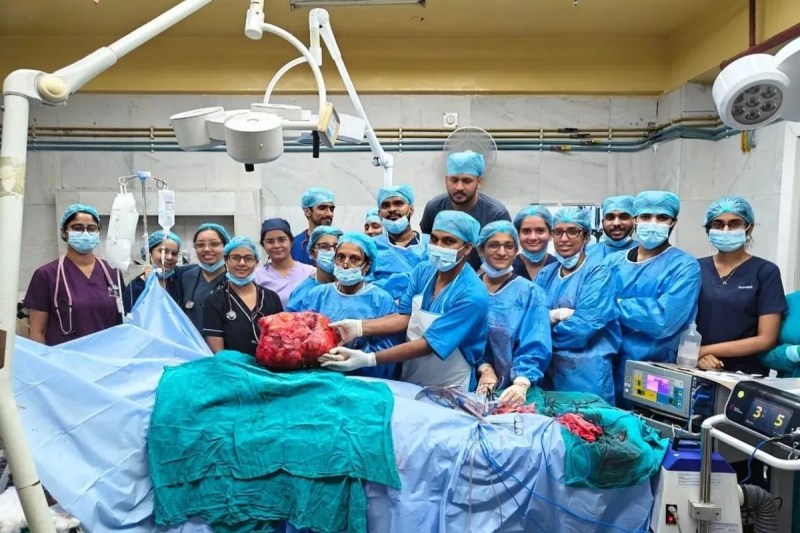Delhi Safdarjung Hospital Doctors removed 10 kg tumor in stomach 19-year-old girl