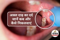 Wisdom Teeth Pain