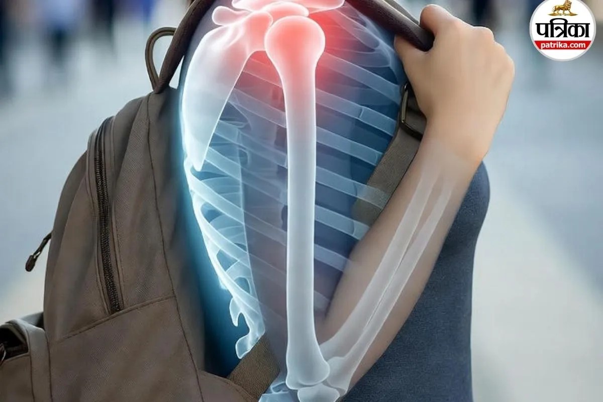 Arthritis, Health, Lifestyle, Shoulder arthritis, carrying bag, shoulder,