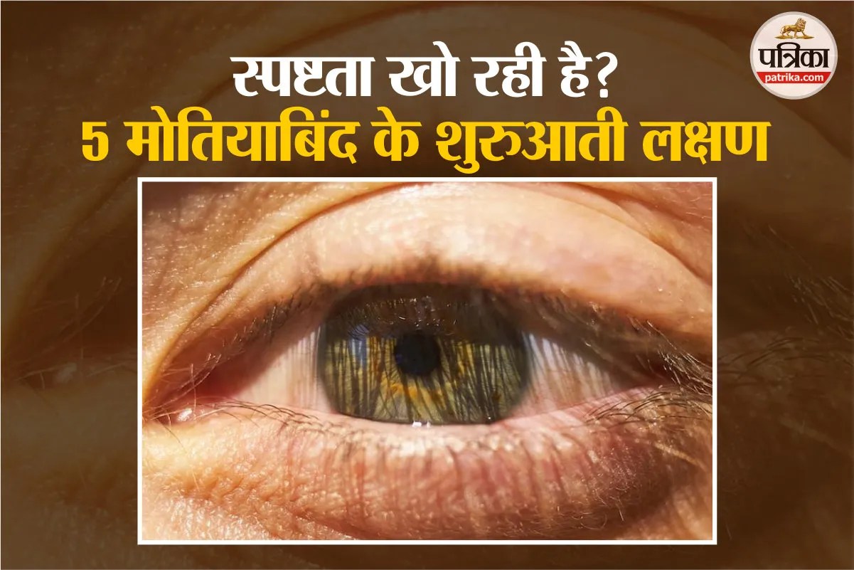 cataract signs,cataract and vision, Early Signs of Cataracts,
