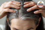 premature greying of hair,causes of white hair,Health Conditions Causing Grey Hair,