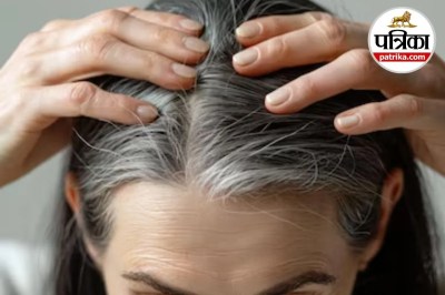 premature greying of hair,causes of white hair,Health Conditions Causing Grey Hair,