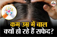 premature gray hair, Vitamin B12 deficiency, causes of white hair,