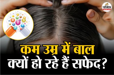 premature gray hair, Vitamin B12 deficiency, causes of white hair,