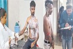 आग की लपटों में झुलसे दो युवक (photo source- Patrika)