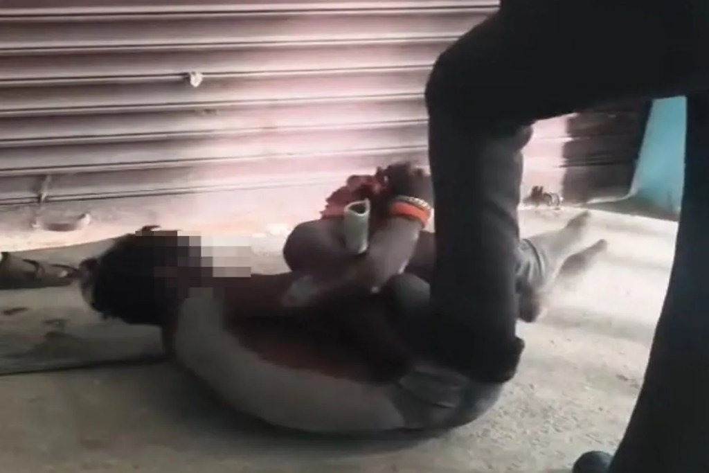 Brutally beaten case