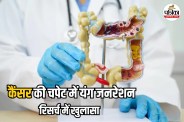Colorectal Cancer in Young Adults