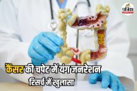 Colorectal Cancer in Young Adults