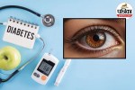 Diabetes Eye Disease, Diabetic Retinopathy Symptoms, Diabetes and Blindness,