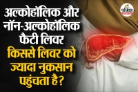 NASH vs fatty liver, Liver inflammation, Fatty liver stages,