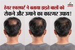 Hair Loss expert tips, regrow hair treatment, ganjapan kaise roke,