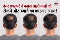 Hair Loss expert tips, regrow hair treatment, ganjapan kaise roke,