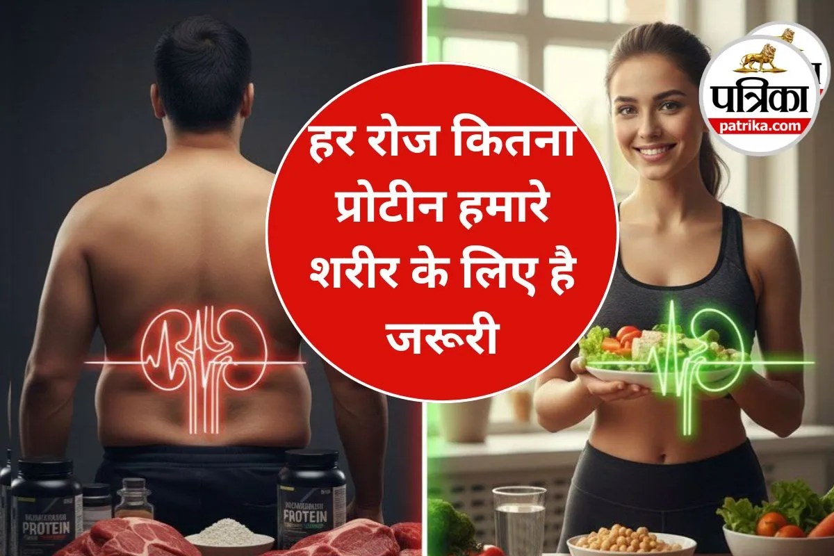 High Protein Diet