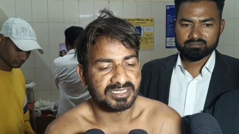 घायल अधिवक्ता (फोटो सोर्स- पत्रिका)