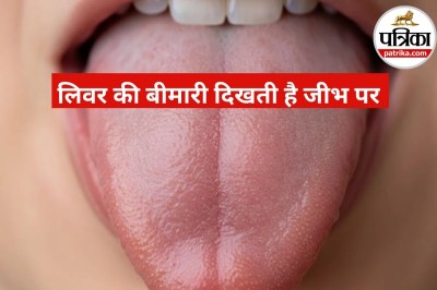 Liver Damage Symptom on Tongue
