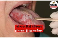 Oral Cancer Symptoms