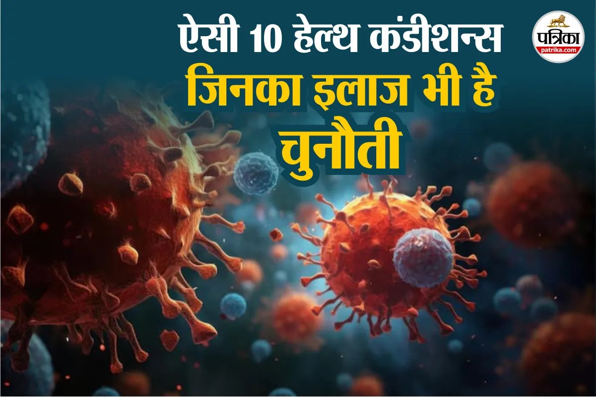 Rare diseases, Rare diseases in the world, Rare medical conditions, Water allergy disease,