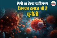 Rare diseases, Rare diseases in the world, Rare medical conditions, Water allergy disease,