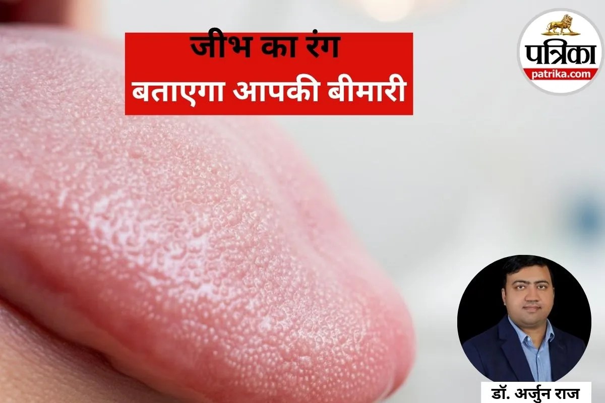 Tongue colour symptoms