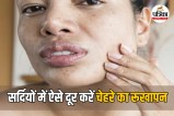Winter Skin Care Routine in Hindi