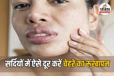 Winter Skin Care Routine in Hindi