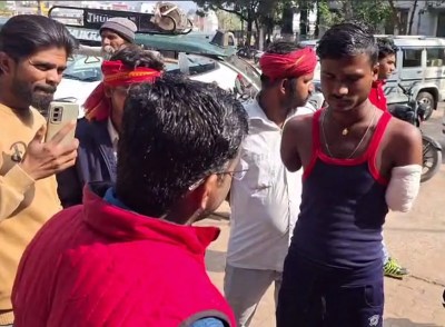 छतरपुर में करंट लगने से हुई दुर्घटना में मजदूर के कट गए हाथ, अब आर्थिक तंगी से जूझ रहा युवक