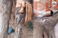 पत्थर बनती जा रही 14 साल की मासूम (फोटो सोर्स- पत्रिका)