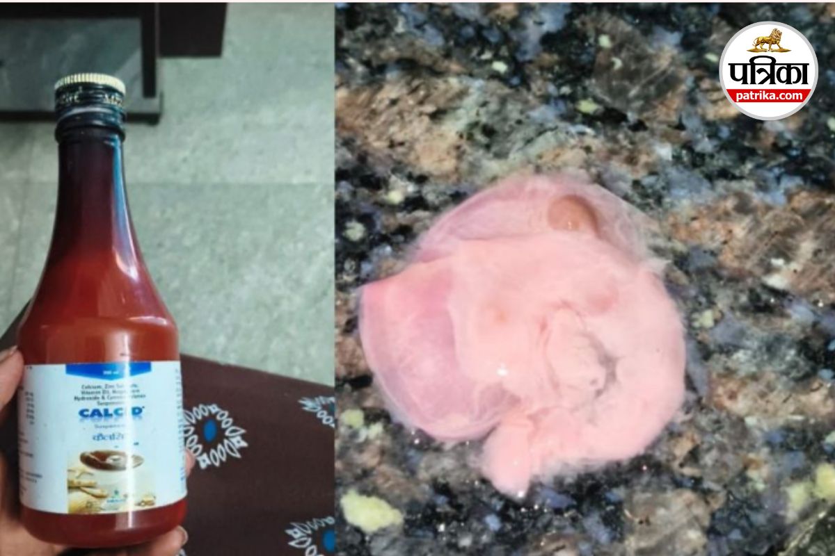CG News: सरकारी अस्पताल से मिली कैल्शियम सिरप की बोतल में मांस का टुकड़ा! Video Viral…