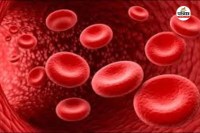 CG News: आदिवासी अंचलों में सिकल सेल का कहर(photo-patrika)