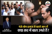 Ganjapan Ka ilaj, Ganjapan Ka Ayurvedi ilaj, baal ugane wala tel, baal ugane wala dawa,