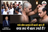 Ganjapan Ka ilaj, Ganjapan Ka Ayurvedi ilaj, baal ugane wala tel, baal ugane wala dawa,