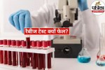 Human Rabies Test