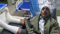 पुलिस की पिटाई से दोनों पैरों में फ्रेक्चर (फोटो सोर्स- पत्रिका)