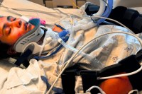 Indian Girl Coma In USA