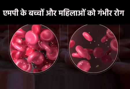 एमपी के बच्चों और महिलाओं को गंभीर रोग