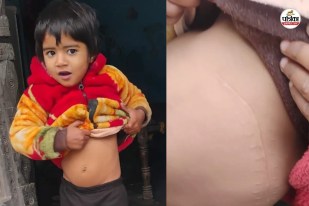 Kidney-Theft-case