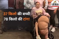 Leg Overgrowth Disorder