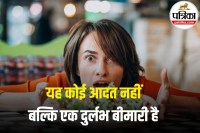 Marcus Gunn Syndrome