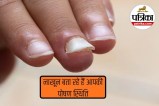 Nail health warning signs, Nail color changes causes, Sudden nail color change,