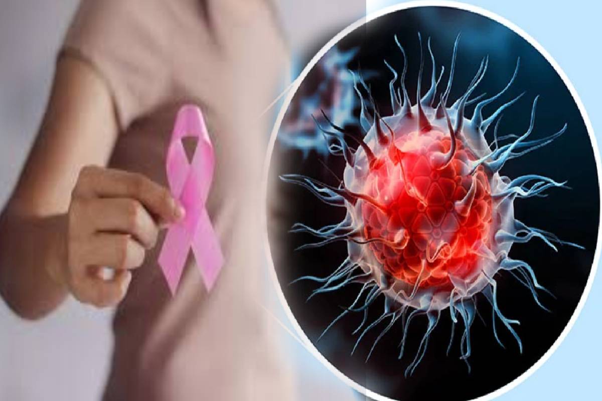 breast cancer