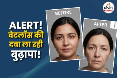 Ozempic face before after photo, Ozempic face care, Ozempic skin, Ozempic se kya hota hai, Ozempic side effects, Ozempic bad or good for skin,
