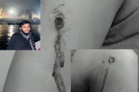 आधी रात घर में घुसकर तोड़फोड़, मारपीट और फायरिंग; युवती गंभीर घायल      (फोटो सोर्स :  Police Media Cell )