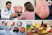 Winter Skin Disease, psoriasis in winter