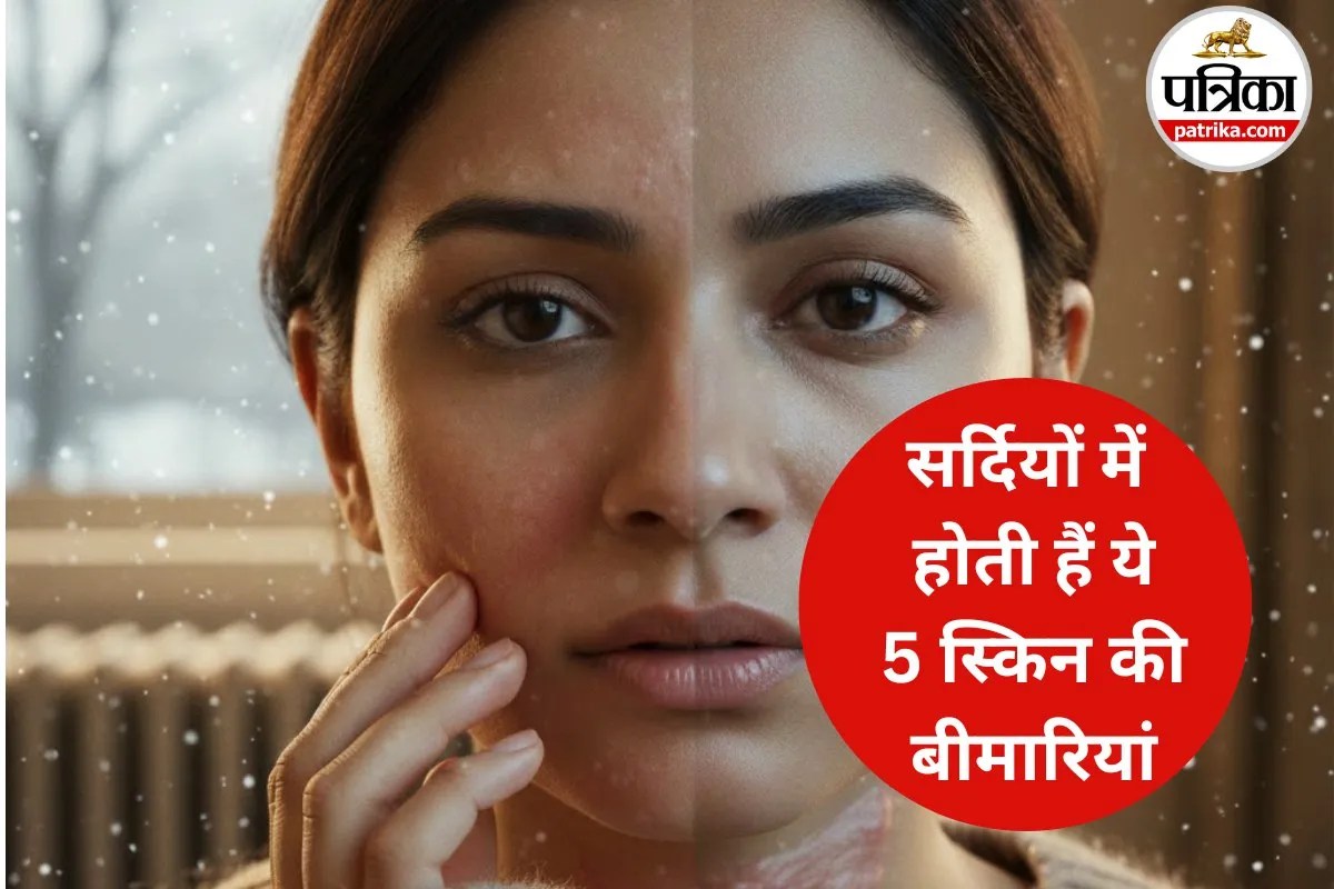 Winter Skin Disease