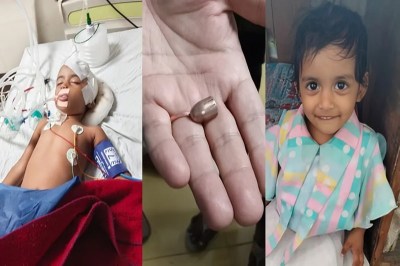 मामूली चोट समझ डॉक्टर ने टांके लगाए; सर्जरी के बाद हालत स्थिर (फोटो सोर्स : WhatsApp News Group)