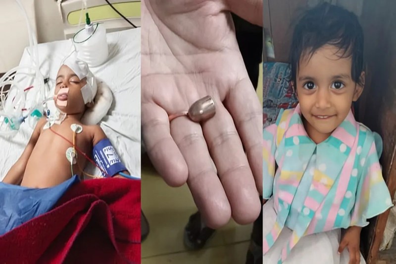 मामूली चोट समझ डॉक्टर ने टांके लगाए; सर्जरी के बाद हालत स्थिर (फोटो सोर्स : WhatsApp News Group)