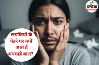 Facial Hair In Girls