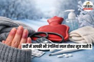 Winter Skin Disease, Chilblains symptoms, Swollen fingers in winter